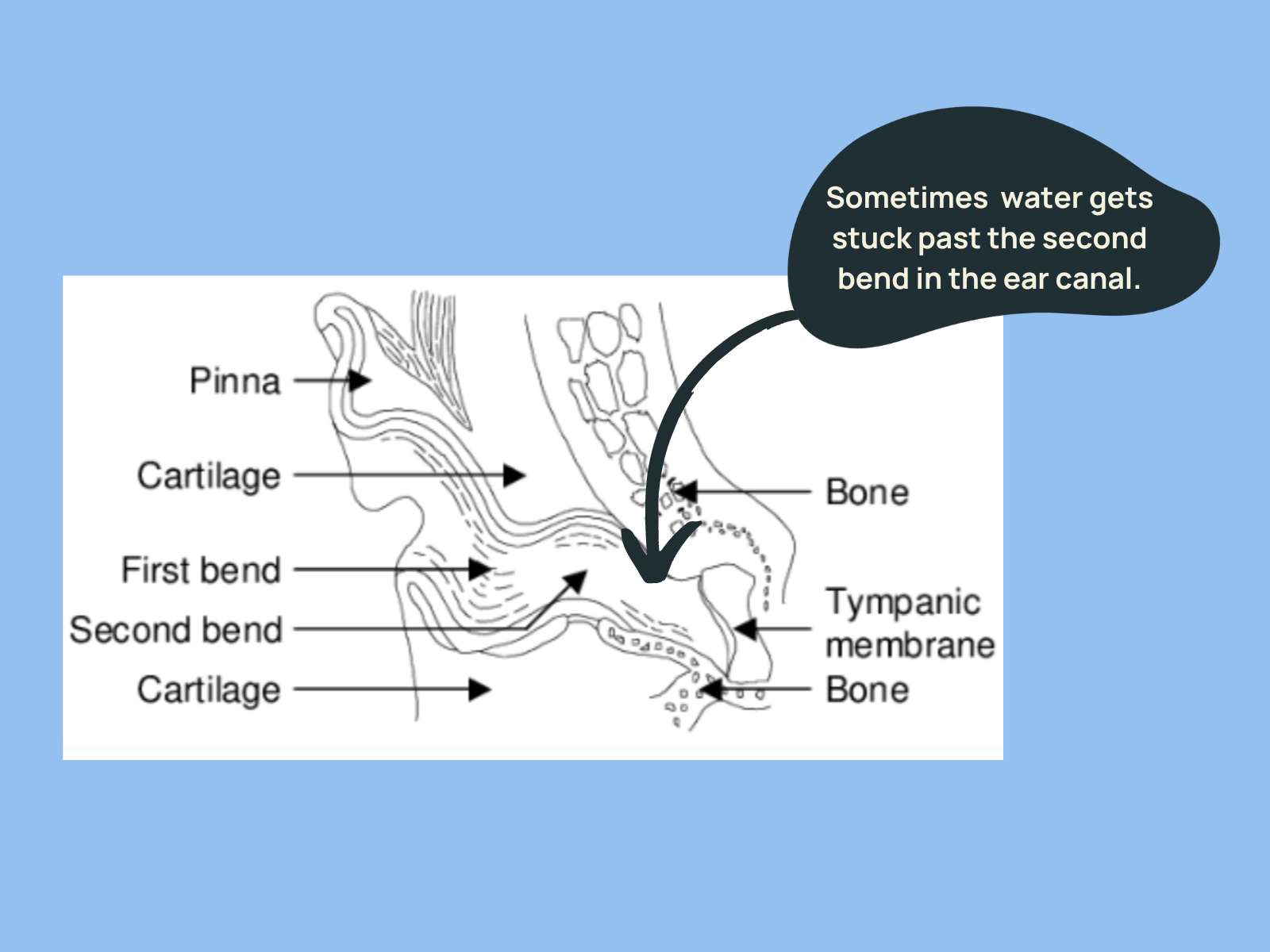 What Is The Trapped Water Theory Water Stuck in Your Ear? Here's How to Get It Out.